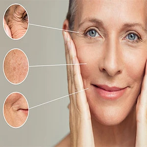 7 روش فوق العاده برای رفع چین و چروک پوست