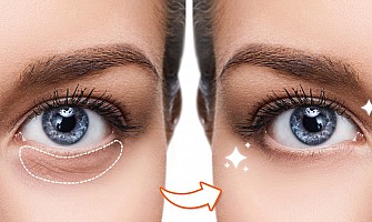 ساده ترین شیوه ها برای از بین بردن سیاهی زیر چشم