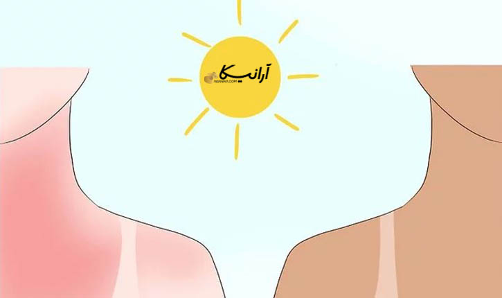 واکنش پوست به نور خورشید